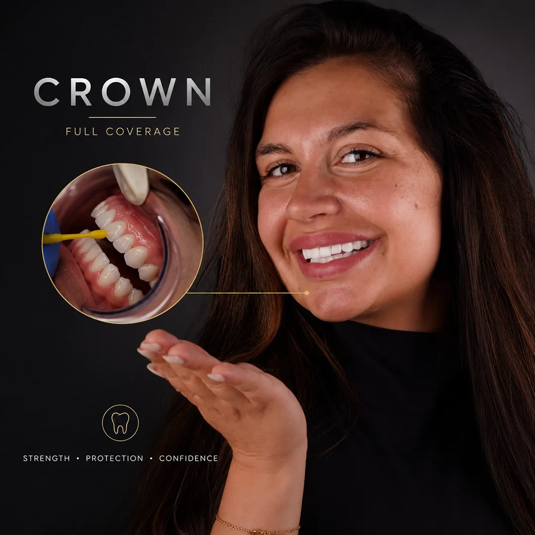 How Can You Tell If You Have Veneers or Crowns