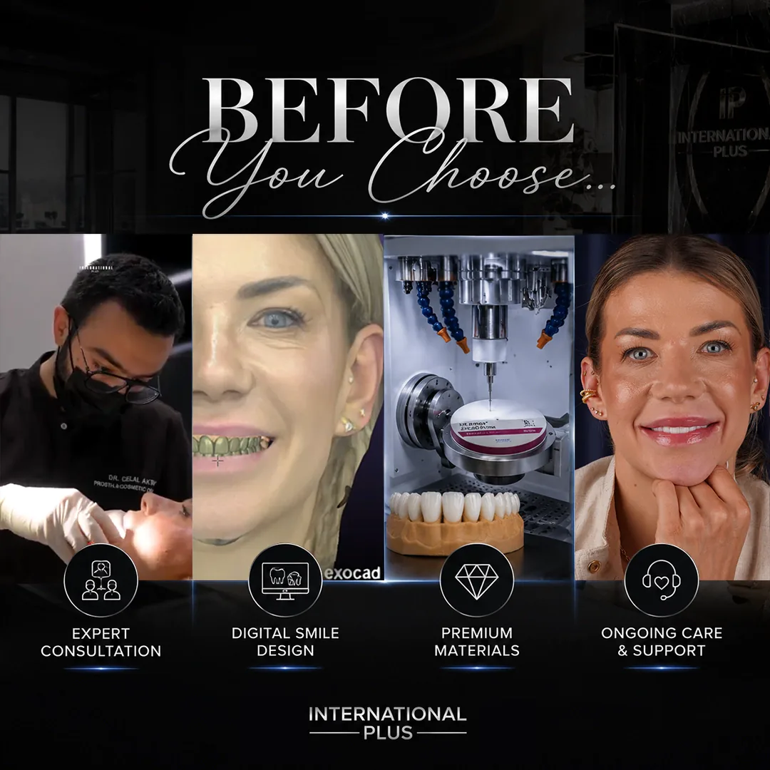 How Our Clinic Weighs Turkey Teeth vs UK Dentist Care