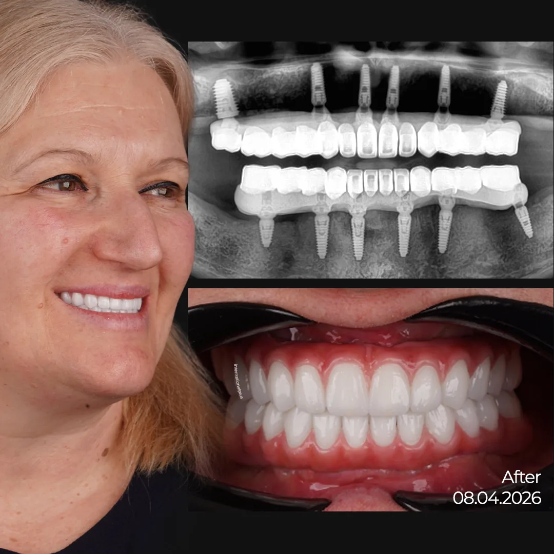 Lela's Story Years of Avoiding the Dentist