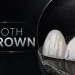 Tooth Crown Materials, Lifespan and Care Explained