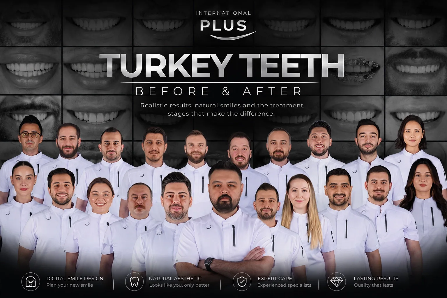 Turkey Teeth Before and After: Realistic UK Results