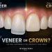 Turkey Teeth Veneers or Crowns The Real Difference