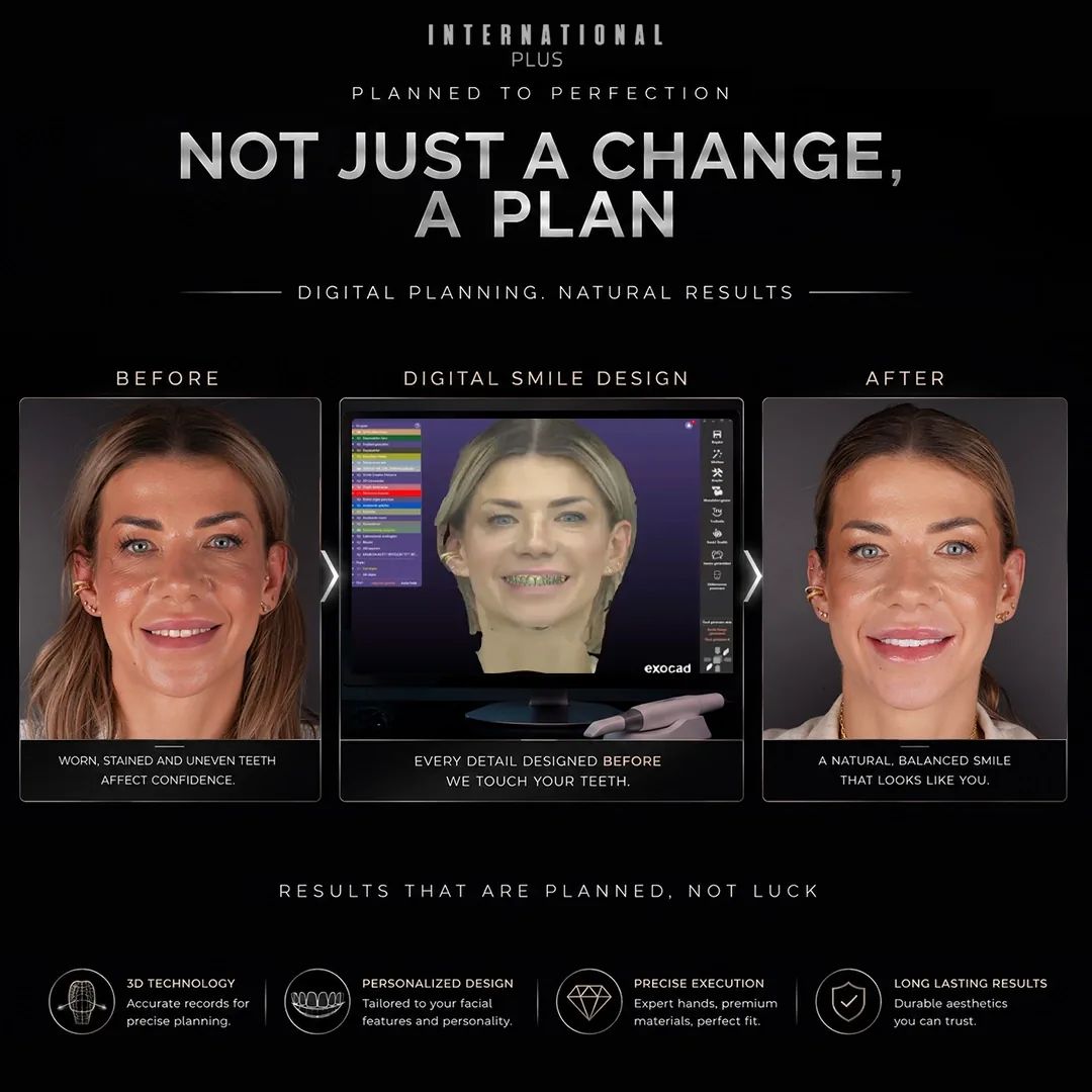 What Do Turkey Teeth Before and After Results Look Like
