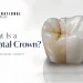 What Is a Dental Crown Purpose, Procedure and Lifespan