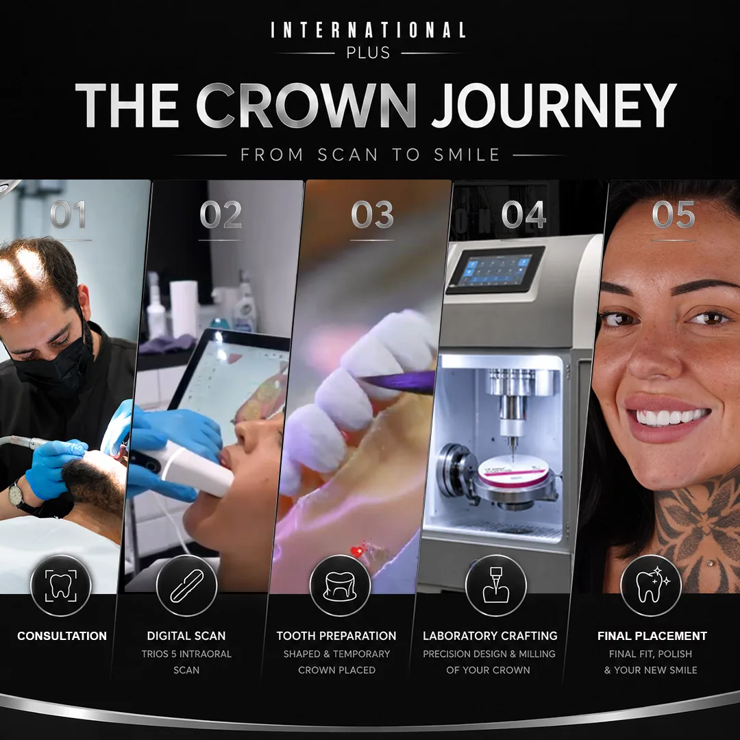 What Is a Dental Crown and When Is One Needed