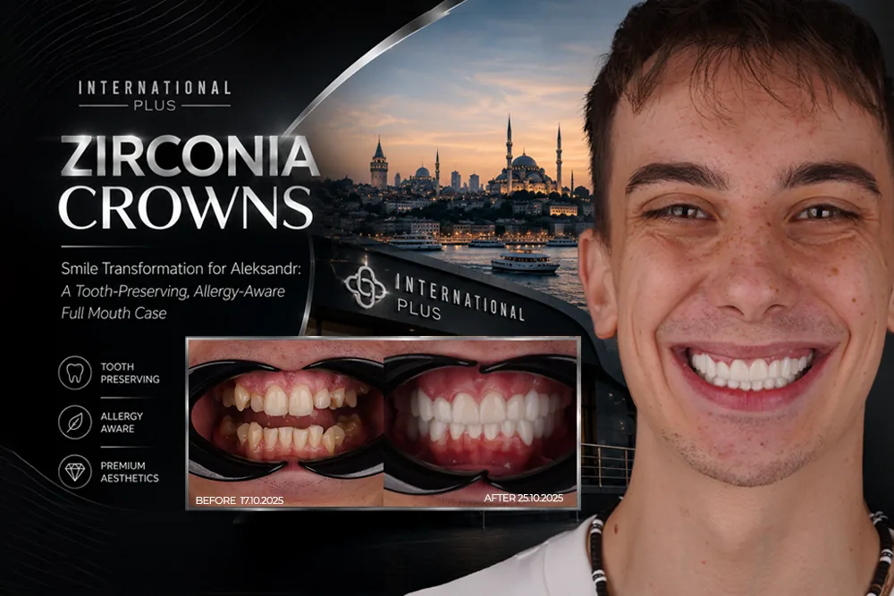 Zirconia Crowns Smile Transformation: Aleksandr’s Case