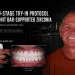 A Two Stage Try In Protocol for Wolfgang Post and Core Abutments Beneath a 24 Unit Bar Supported Zirconia Rehabilitation