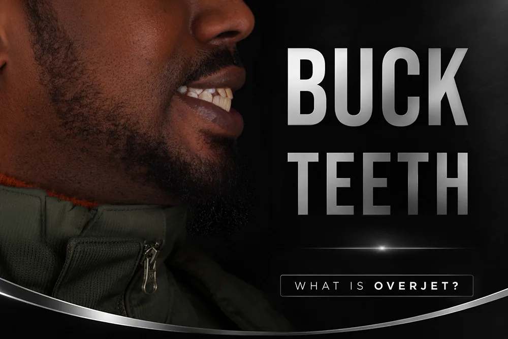Buck Teeth: Causes, Treatment Options and How to Fix Protruding Front Teeth