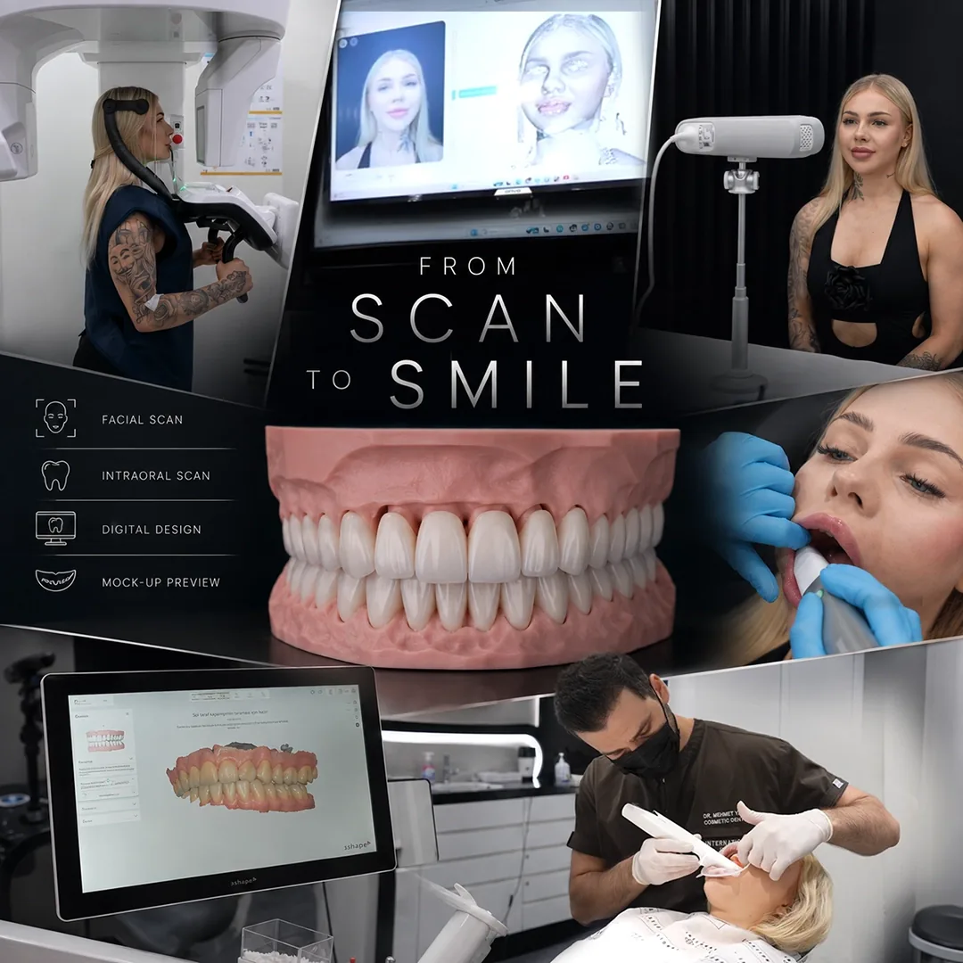 How do AI smile filters distort patient expectations
