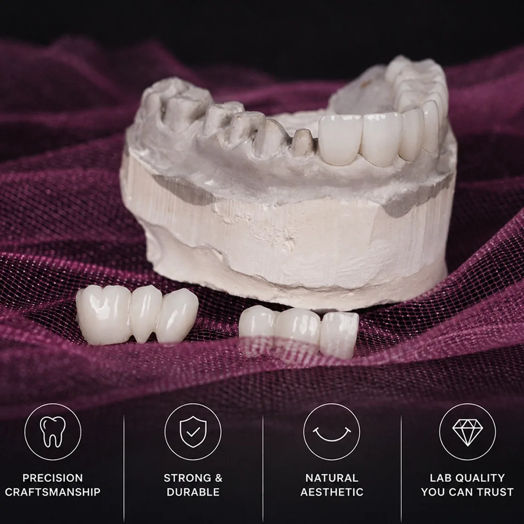 How long does a dental bridge last and how do you care for it
