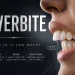 Overbite Teeth Causes, Health Risks and How to Fix a Deep Bite