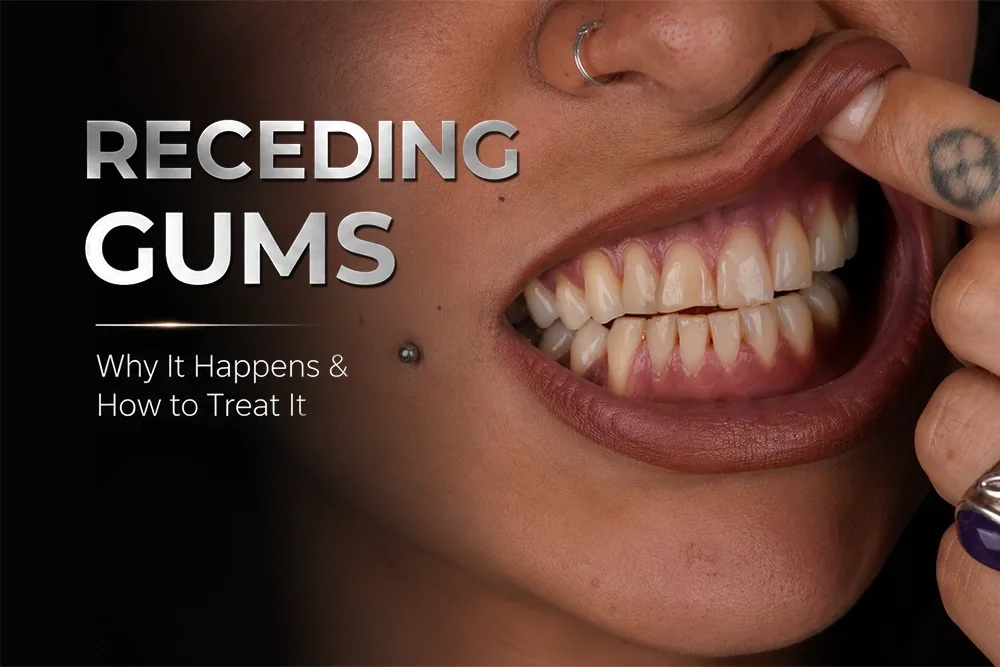 Receding Gums: What Causes Recession and How to Fix It