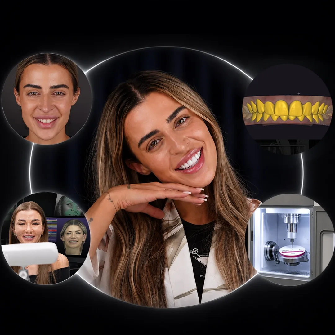 What Is 3D Smile Design and Which Data Does the Design Need