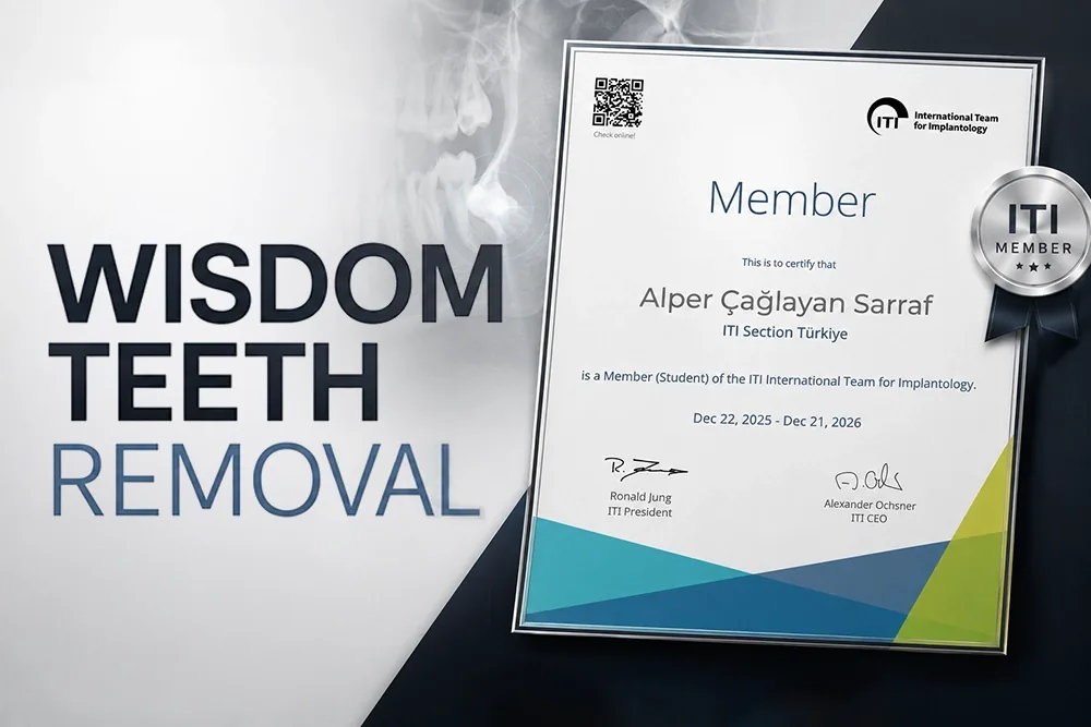 Wisdom Teeth Removal: Procedure, Recovery and When It Is Needed