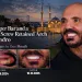 An Upper Bar and a Lower Screw Retained Arch for Sandro Two Designs in One Mouth