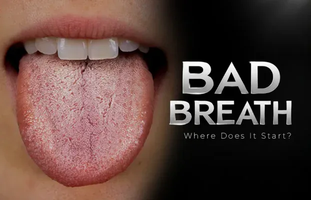Bad Breath: What Causes It and How to Get Rid of It