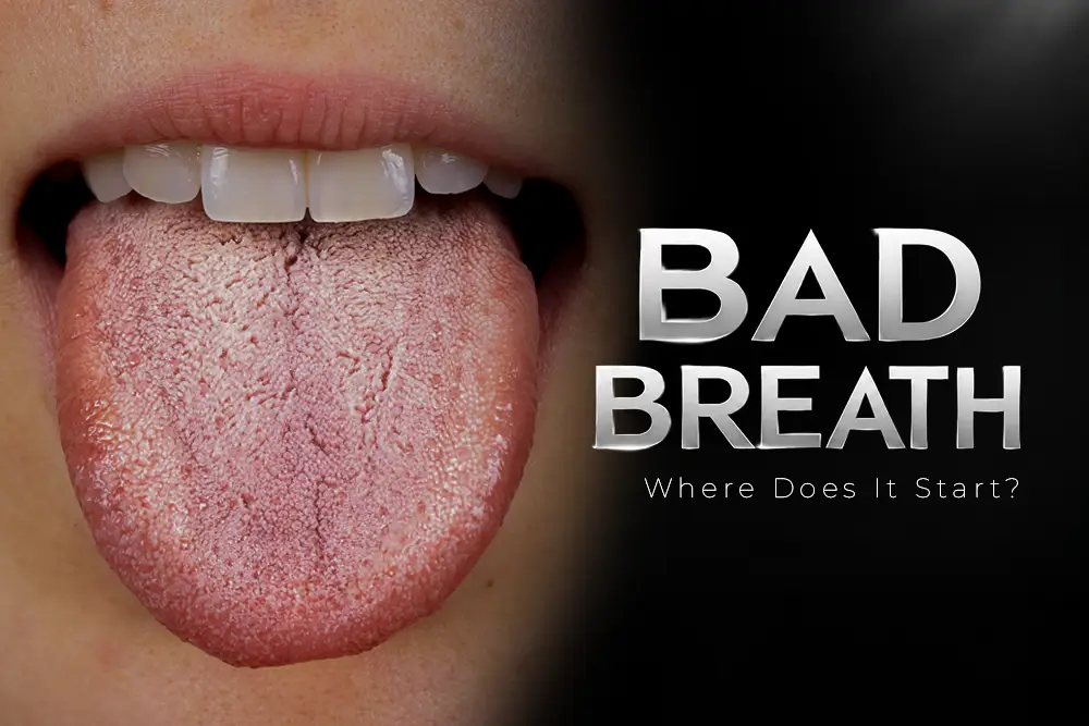 Bad Breath: What Causes It and How to Get Rid of It