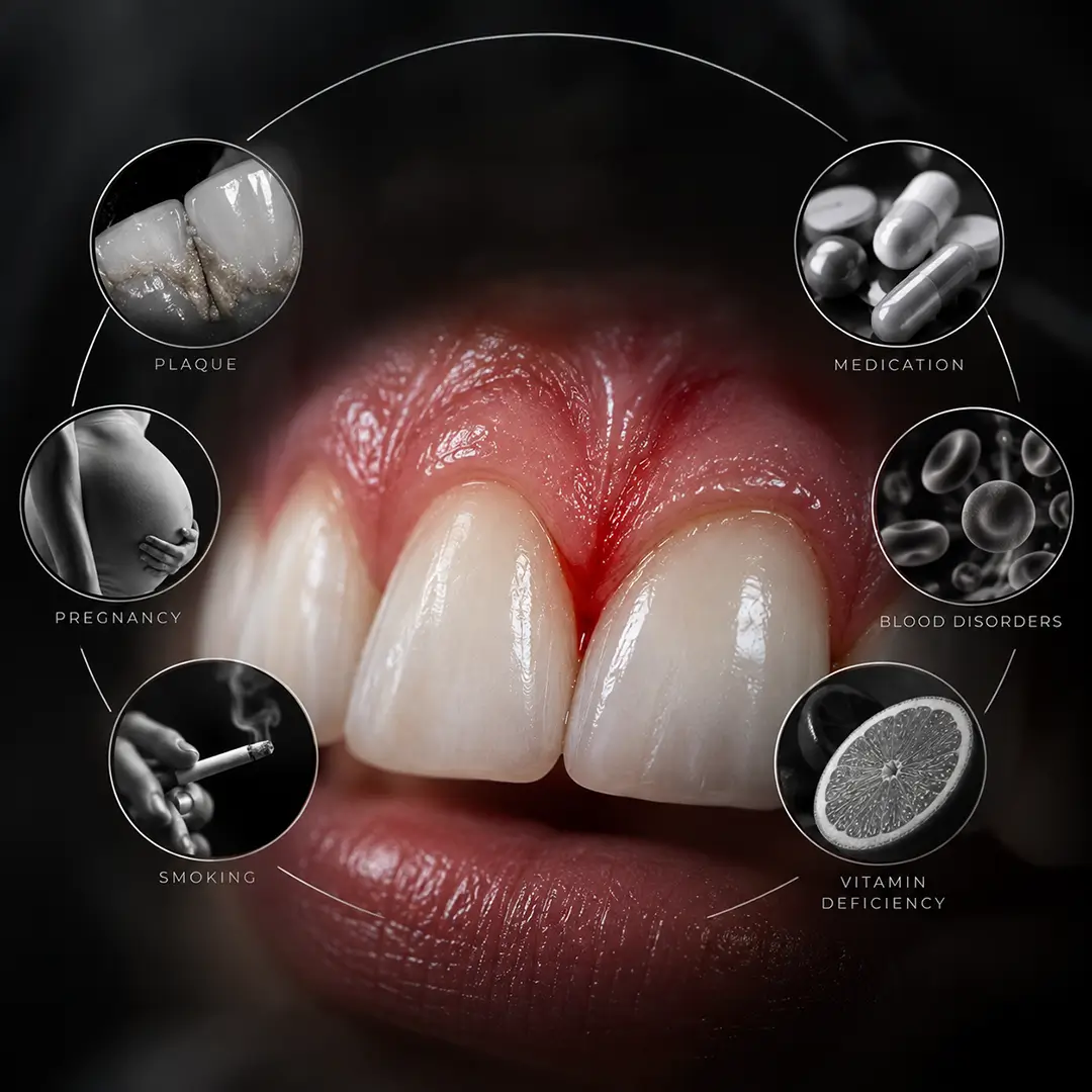 Bleeding Gums During Pregnancy