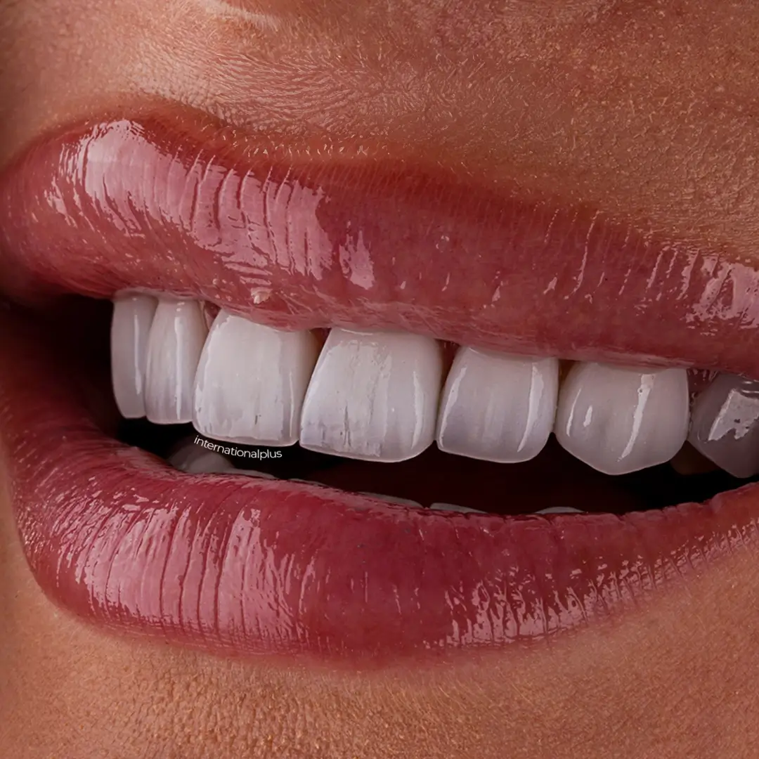 Bonding and Why It Matters for Thin Facings
