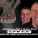 Choosing a Smile Design Style Valentin's Record and the Plus 5 Aggressive Preset