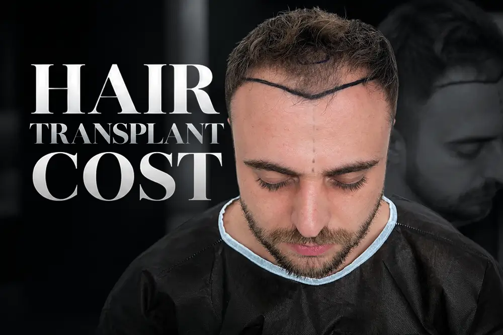 Hair Transplant Cost: What Really Drives the Price