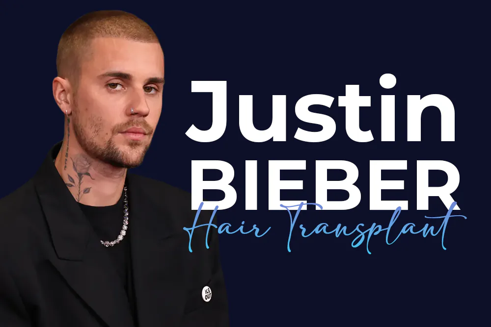 Justin Bieber Hair Transplant: What Is Confirmed and What Is Guesswork