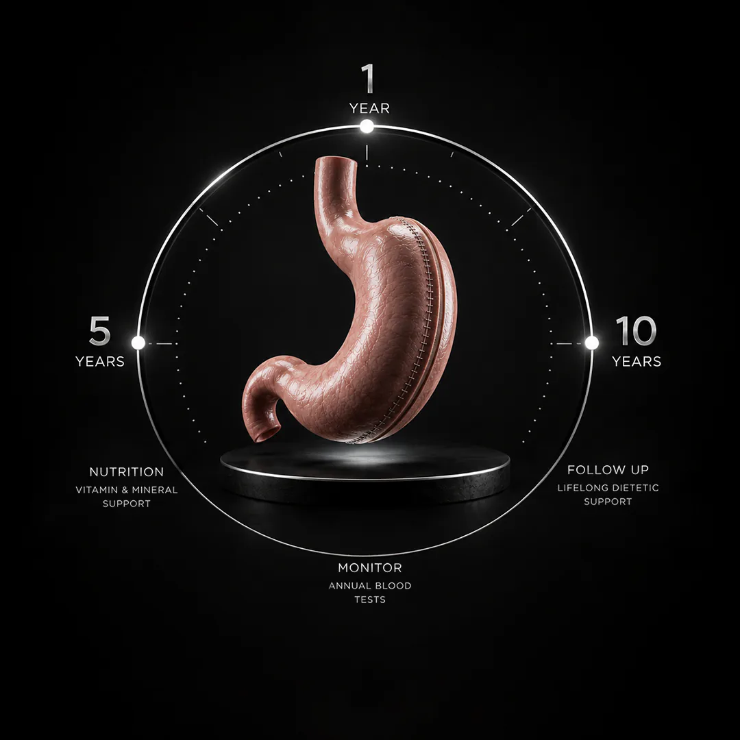 What Is a Gastric Sleeve Operation in Clinical Terms